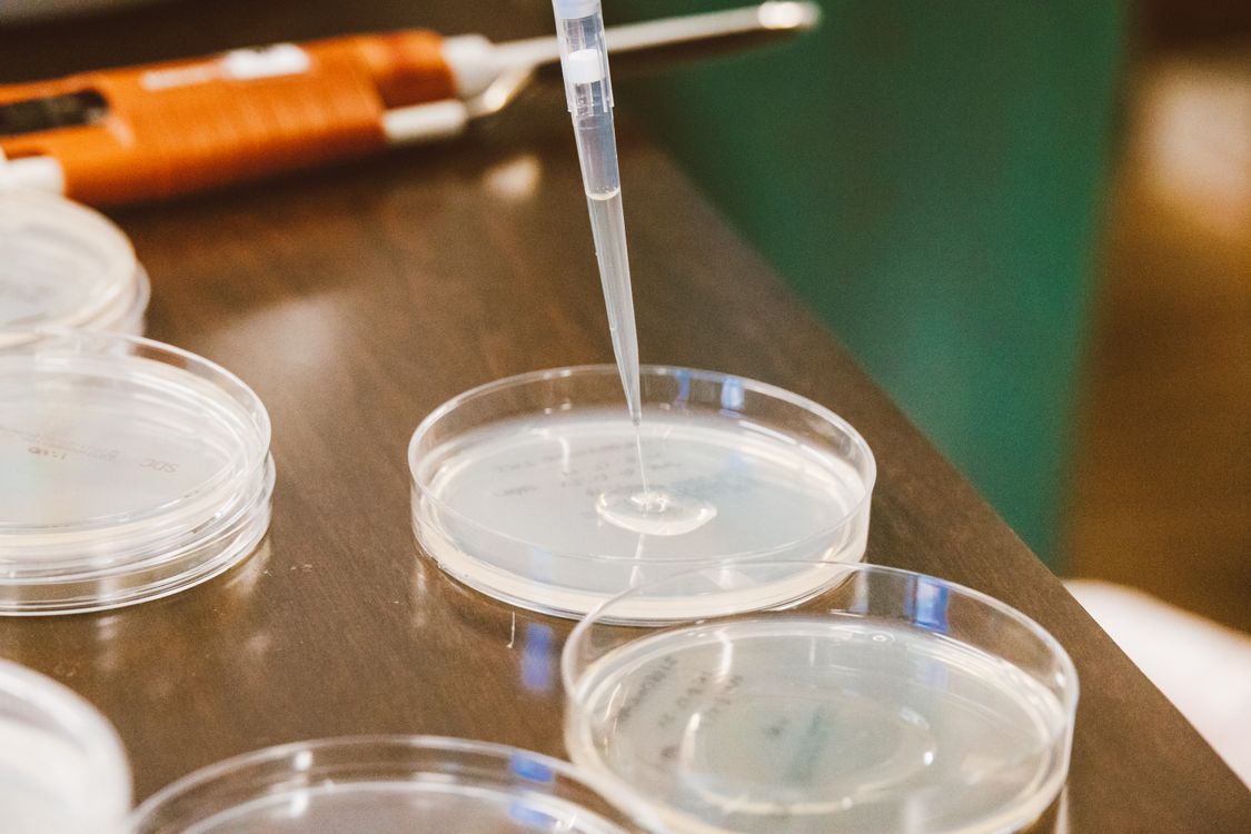 Laboratorijska provera uzorka pomoću pipete